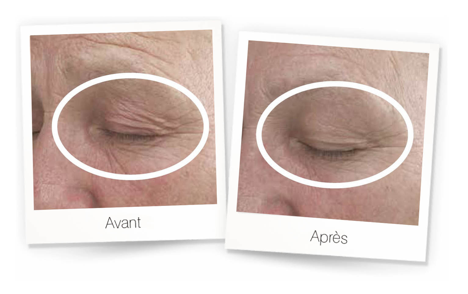 mpr-visage mpr visage
